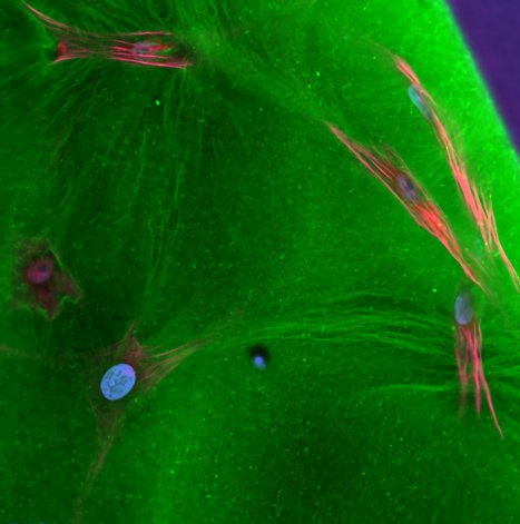 Hey everyone! We are recruiting a postdoc to work on projects in MSK tissue repair/preservation,  understanding how cell-scale interactions and remodeling govern tissue response. I am fully vested in mentoring you to the next stage, academically and professionally! RT's welcome