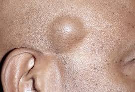NizaAsili's tweet photo. NUNDU kama hii pichani,  UNAYO?

Kama jibu ni ndiyo, kuna tiba rahisi nakupatia ila kwanza naomba RT, pitia pinned tweet, follow @NizaAsili kisha save 0788700445 Whatsapp
*********************

#DUSHI Tiba Lishe ya TAIFA inaendelea kuokoa NDOA, Usiikose

Haya tuendelee 👇 https://t.co/akZGCC3RZX
