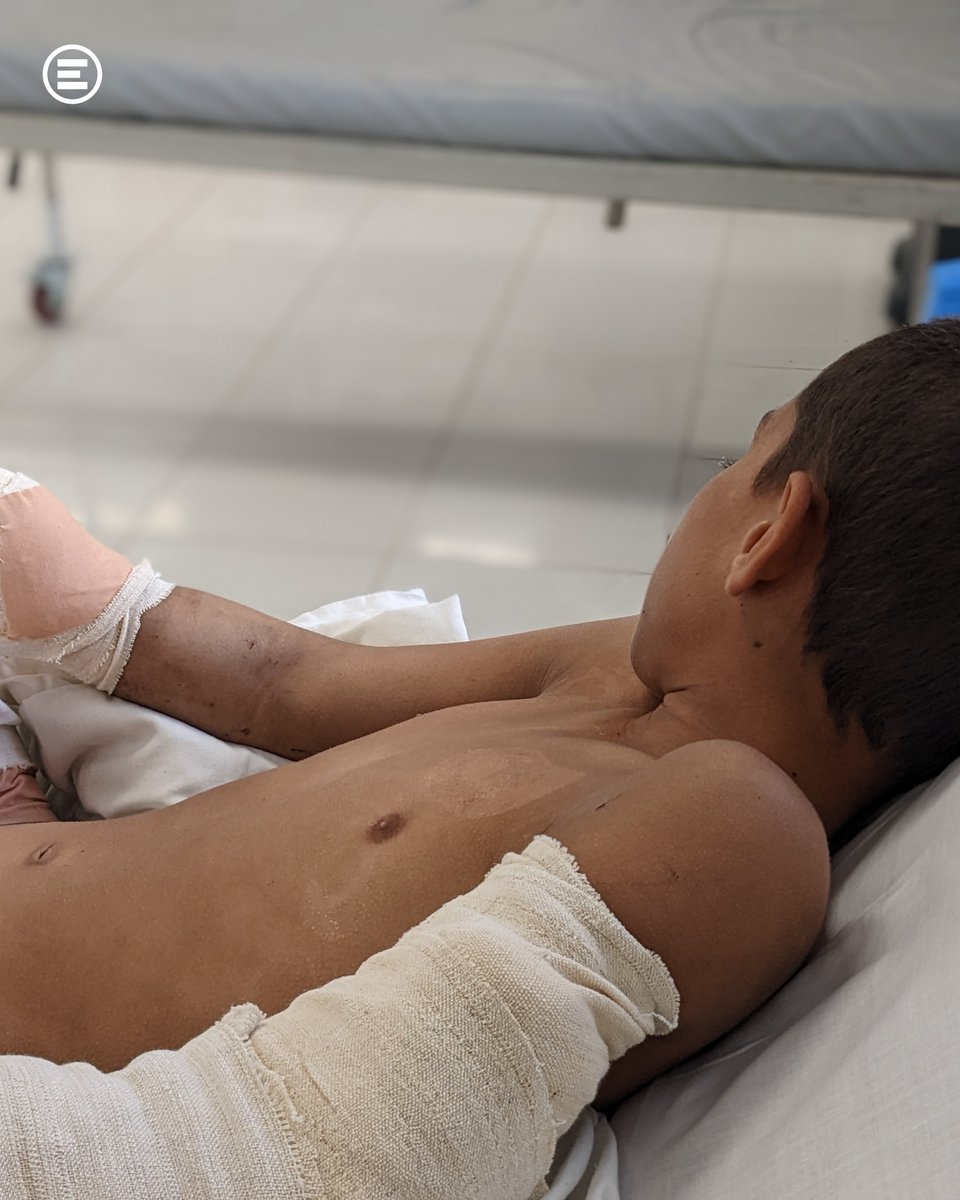emergency_ong's tweet photo. Mohammad e Shamsia stavano giocavano con un oggetto metallico che si è rivelato una #minaantiuomo: dal più vicino Posto di Primo Soccorso li abbiamo trasportati e curati nel nostro Centro di #Lashkargah.
Leggi la loro storia > https://t.co/fHtdV1WEIm

#laguerraè #MineAwarenessDay https://t.co/RCeyHm9dam