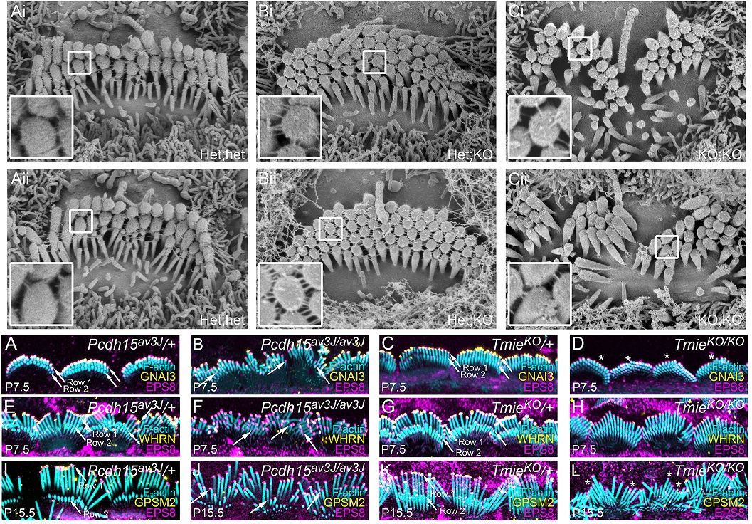 PLOSBiology's tweet photo. SIM & surface rendering reveals that #InnerEar #HairCells constantly supply #stereocilia building blocks to the hair bundle, but the unique protein composition at the tips of each row of stereocilia ensures that the rows grow differentially #PLOSBiology https://t.co/UHzhw1VvA9 https://t.co/6IpN6YE3nO