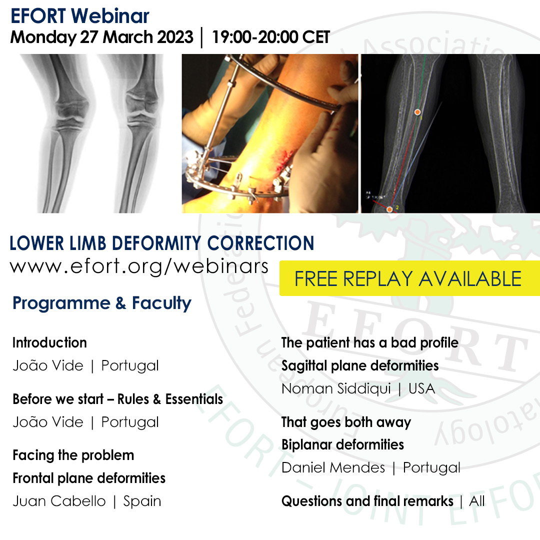 EFORTnet's tweet photo. 🎬 If you missed the free EFORT #Webinar on #LowerLimb #DeformityCorrection chaired by João Vide, Portugal it is now available for #REPLAY ▶️Access to replay: https://t.co/zIMj8IJMby #orthopaedics #orthotwitter #orthopedics #sagittalplane #biplanar #deformities #correctivesurgery https://t.co/k9yQHhtiiR