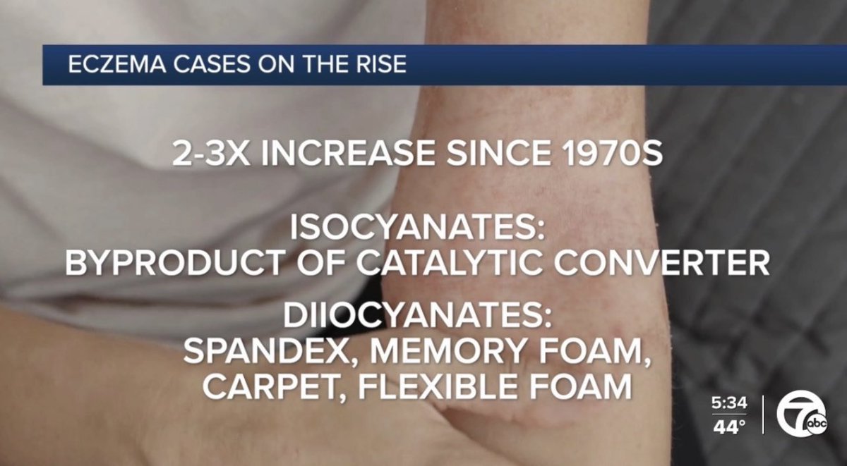 DrGPiro's tweet photo. In eczema news…
Be on the look out for these following items that can irritate your skin. 👀🩺 #howell #brighton #dermatology #ezcema https://t.co/KvB4nWgjfc