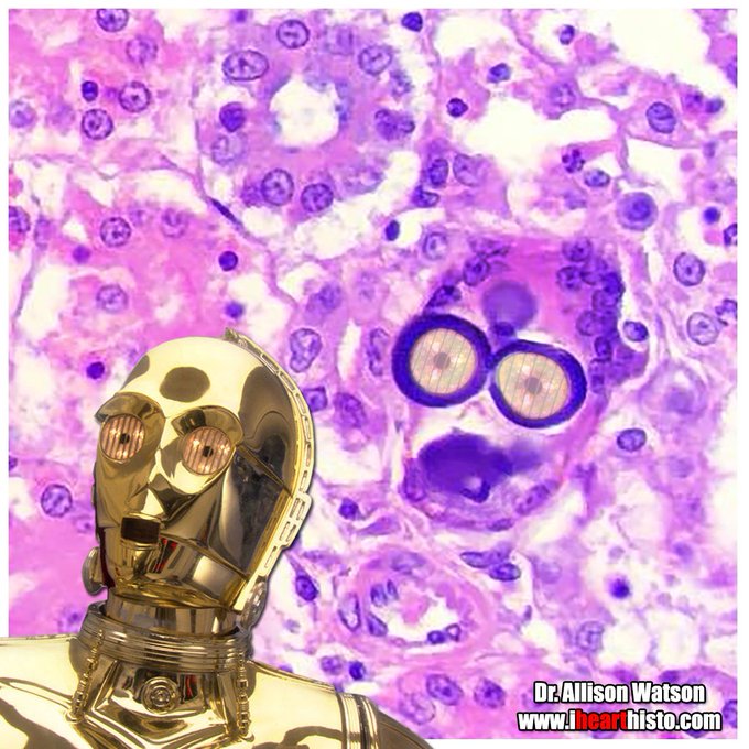 🎬🤖 💦 C3-PEE-O 💦🤖🎬

MAY THE FOURTH BE WITH YOU!

Enjoy this protocol droid in a renal tubule.

C-3PO's head is part of a nephron &amp; contains aggregates of mineral (his eyes/mouth)

#histology #anatomy #pathology #pathArt #StarWarsDay