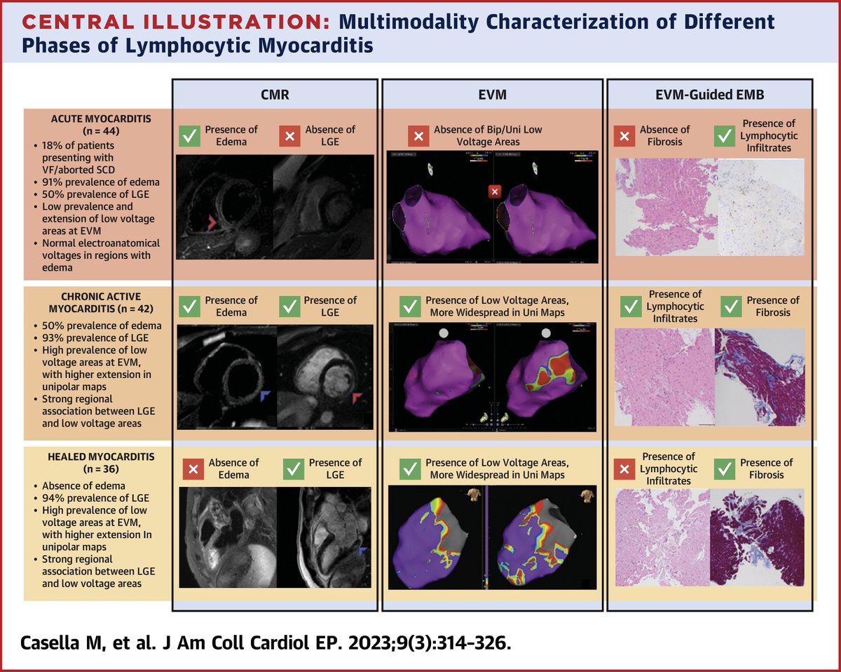 Extensive multimodality assessment of different phases of arrhythmic lymphocytic #myocarditis revealed a strong link between replacement fibrosis & low-voltage areas, but also between edema & normal electroanatomical voltages bit.ly/3zw7WAd

#JACCCEP #cvImaging #cvEP