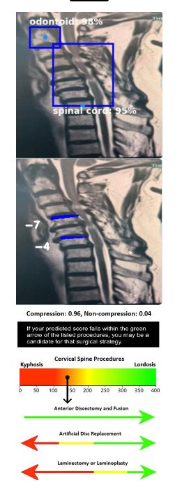 SagittalSpine's tweet photo. @SpineNeuro @spinesection Does physical exam change the treatment strategy? https://t.co/q7EndJtxep
