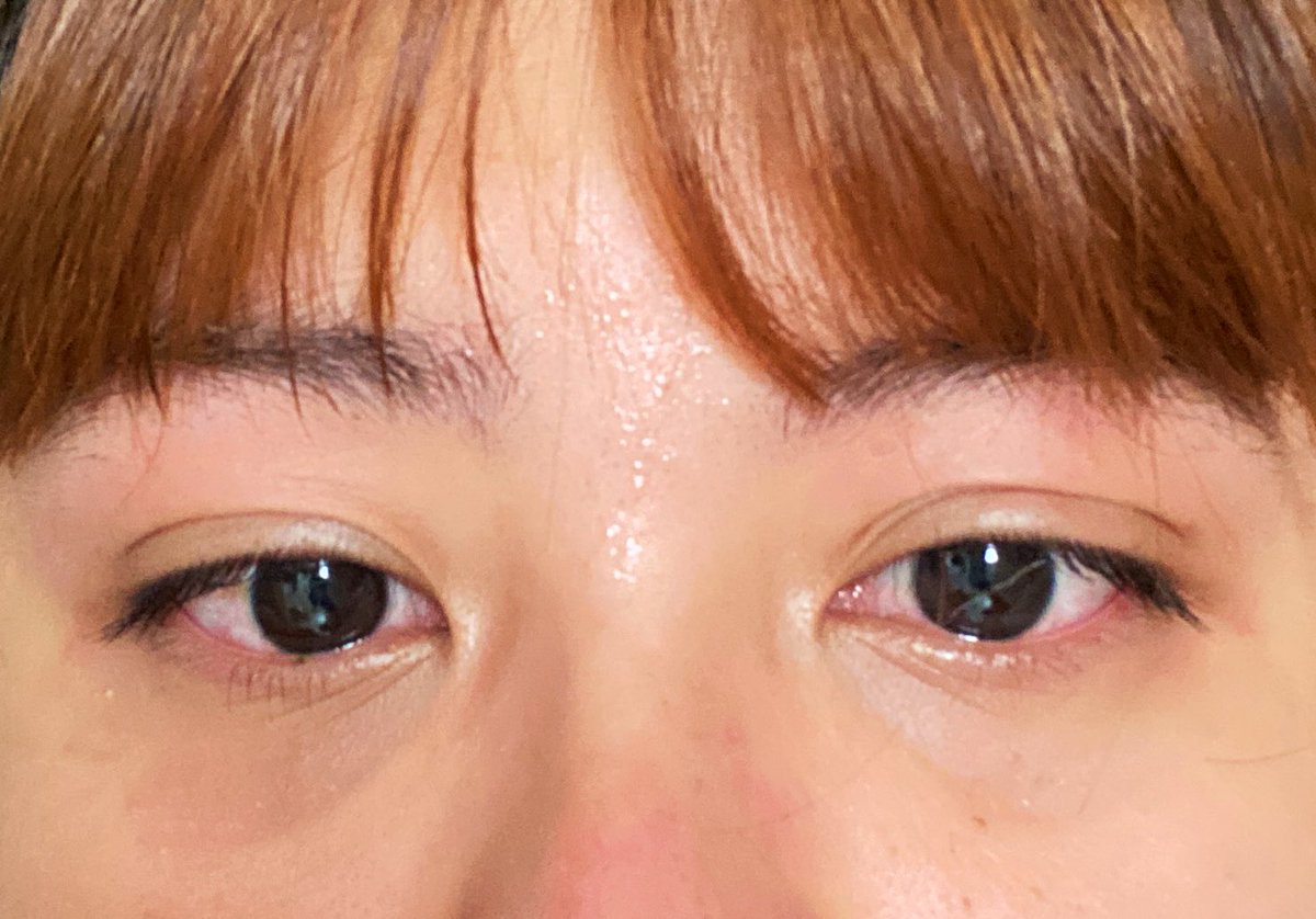 วันนี้ไปเรียนทั้งสภาพงี้อะ เป็นวันที่แย่ไปทุกเรื่องเลย ยกเว้นหน้าตา