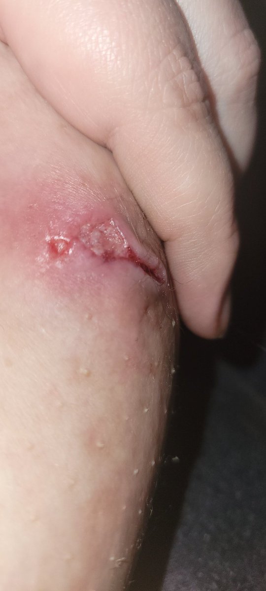 "You're faking it" Cant really fake this...this thing grew in 3 days