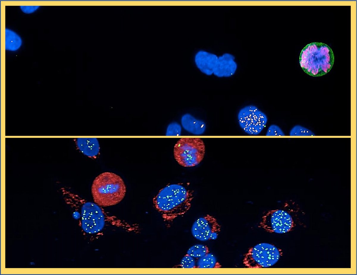 Congrats to Sun et al. for their June 2022 EMM Editor’s Choice Article “A new imaging platform (iScreen) allows for the concurrent assessment of micronucleus induction and genotoxic mode of action in human A375 cells” (doi.org/10.1002/em.224…) #genetictoxicology  #clastogenicity