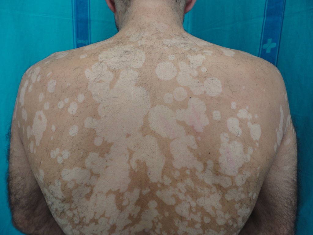 Dr. Francisco Vílchez tweet media