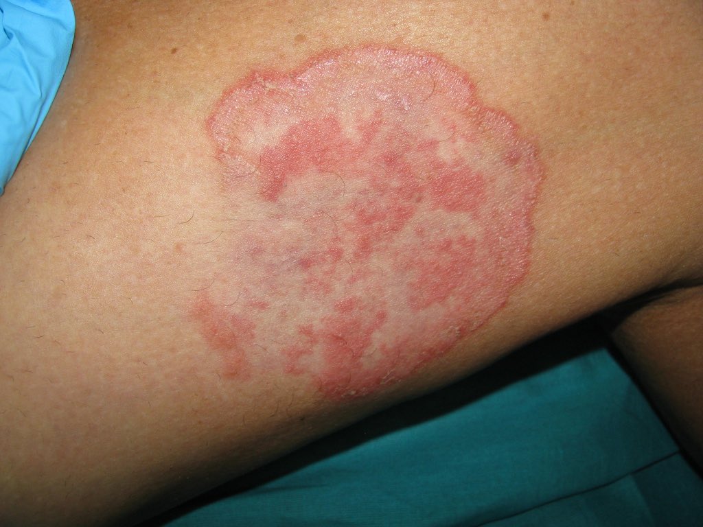 Dr. Francisco Vílchez tweet media