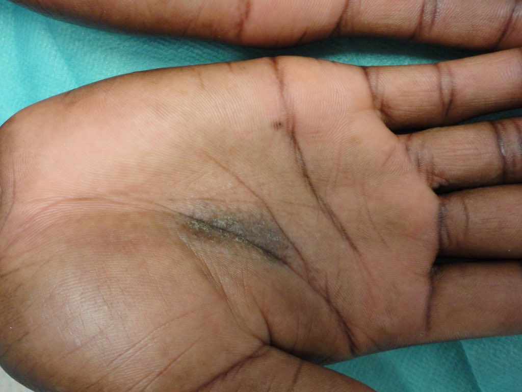 Dr. Francisco Vílchez tweet media