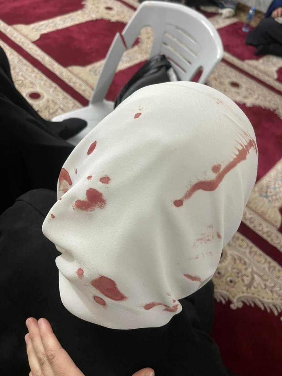 MyPalestine0's tweet photo. #صورة لإصابة إحدى المعتكفات في المصلى القبلي حيث تظهر الدماء على حجابها https://t.co/JY43vkgEFe