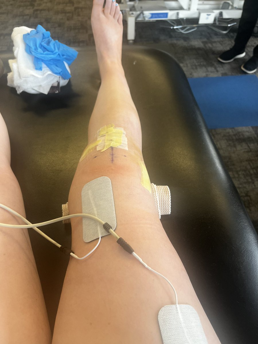 sofia412curtis's tweet photo. First post op pt appointment went great! @ACLclub @ACL_IWBBBTE https://t.co/qsEWdMcNCX