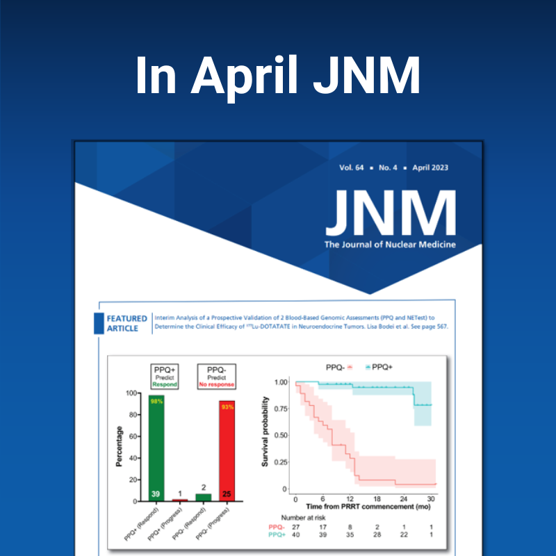 In April JNM—FDA approval of Lecanemab…Buvat/Weber test ChatGPT…Chemotherapy and cognitive impairment…PRRT and NETs…AUC: Lymphoscintigraphy…Featured: PPQ/NETest validation for PRRT…[177Lu]Lu-ofatumumab lymphoma therapy ow.ly/1HJc50NAwj6 #NuclearMedicine #JNuclMed