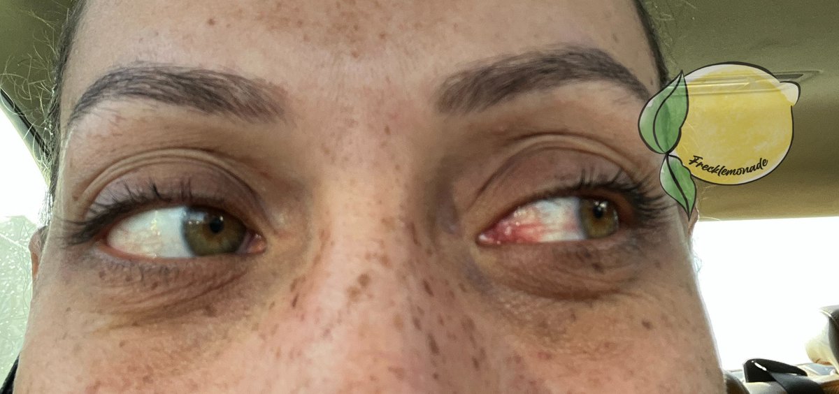 🖤Tang💦 The Facial Queen 🖤 on Twitter: "RT @frecklelemonade: Just left