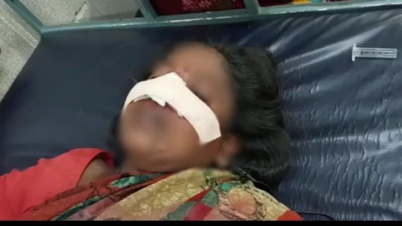 रामराज्य !

यूपी के शाहजहाँपुर में राजेश ने बीच सड़क पर दरांती से महिला की नाक काटी।

दरअसल 3 साल पहले दबंग राजेश ने महिला के साथ छेड़छाड़ की थी और आरोपी के खिलाफ थाने में मुकदमा दर्ज था। मुक़दमा वापस लेने के लिए राजेश काफ़ी दिनों से महिला धमका रहा था।