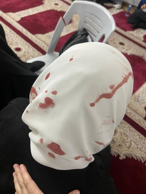 Saudis2018's tweet photo. غابت رجولة حكام العرب والمسلمين
فاعتدى أراذل الناس على حرائر المسلمين 💔
#الأقصى_في_خطر https://t.co/2JWkLAvWTe