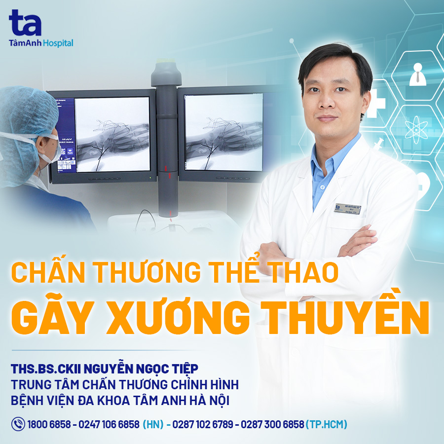 YhocthethaoTA's tweet photo. 💥 Mời quý vị cùng theo dõi video Chấn thương thể thao Gãy xương thuyền tại đây: https://t.co/dWZ4ic030Q
#Benhvientamanh #Tamanhhospital #Hospital #Benhvien #Saudi #Penaldo #Khum #Cháy #Camilla #Quan #Gaza #DOGE https://t.co/uBSPa48nJz