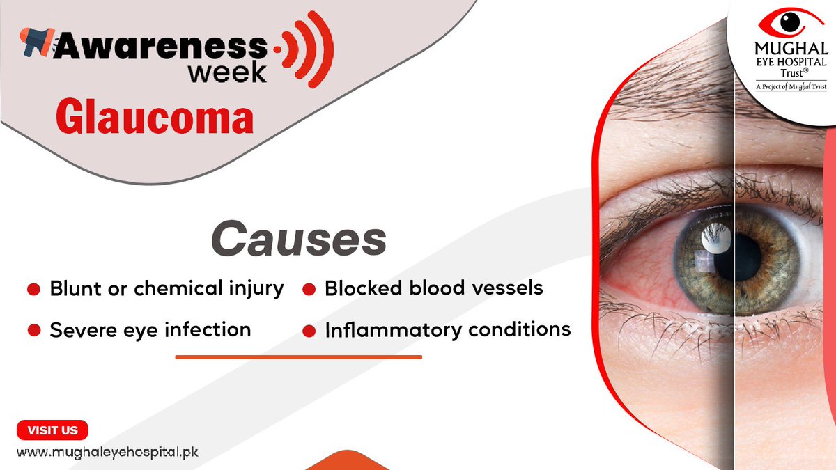 MughalEye's tweet photo. Glaucoma is one of the most serious eye diseases. Visit Mughal Eye Hospital Trust for regular checkups and keep your eyes healthy.  

 #mughaleyetrusthospital #eyecare #glaucoma https://t.co/Twq3fvHkws
