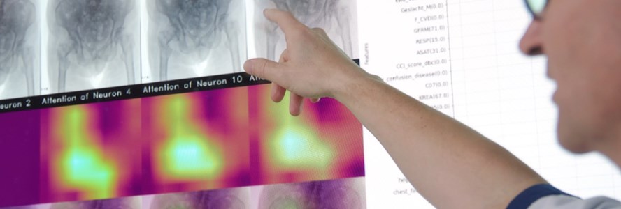 Een unieke ontwikkeling in Nederland. Samen met <a href="/ziekenhuisMST/">Medisch Spectrum Twente</a> <a href="/SKBWinterswijk/">SKB Winterswijk</a> werkt ZGT samen op het gebied van beeldvormende technologie (röntgenfoto’s, CT, MRI, PET-CT scans) met een gemeenschappelijke ICT-oplossing, PACSonWEB.

zgt.nl/nieuws/algemee…