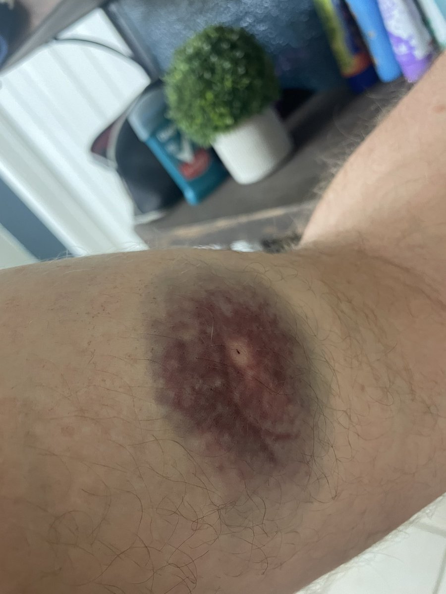Dewormed and COVID free for 180 days at least 😂 Accidentally got myself with the Long Range while deworming heifers. #ouch #COVID19 #health #ok