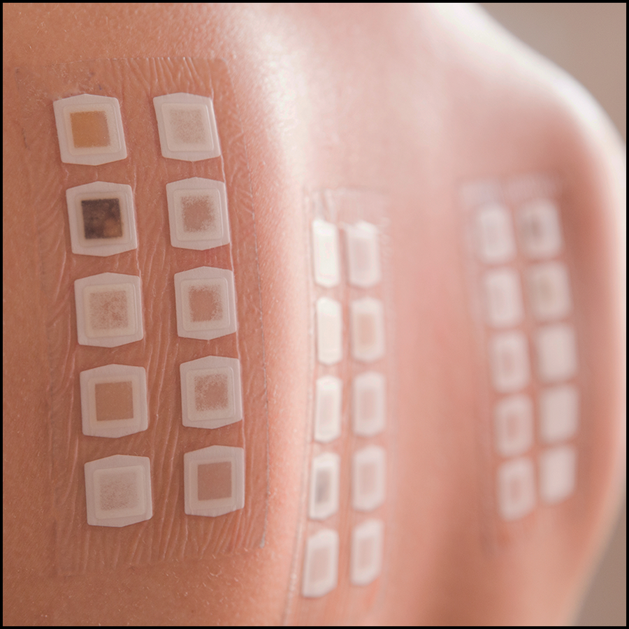 ASALifeline's tweet photo. In a new study published in @_Anesthesiology most allergic reactions to #chlorhexidine were due to skin disinfectant for vascular cannulation and occurred repeatedly in most patients before it was recognized. Read the article: https://t.co/jnt33JasFo https://t.co/xhUNpfgZJG