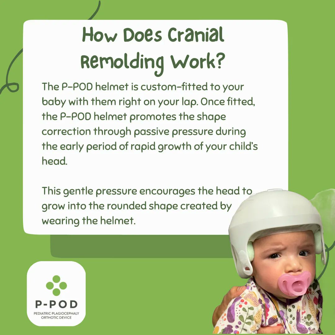 PPODhelmet's tweet photo. The P-POD helmet is custom-fitted to your baby with them right on your lap. Once fitted, the helmet promotes shape correction through passive pressure during the early period of rapid growth. 

Want to know more? Visit https://t.co/mfYsWGyqCt https://t.co/Qt8H2A3ESh