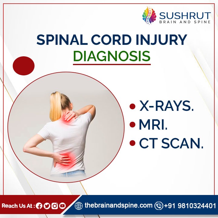sushrutcom's tweet image. Spinal cord injury is defined as traumatic damage to the spinal cord or nerves at the end of the spinal canal.

#spnalcordinjury #spinalcordinjuryrecovery #spinalcordinjuryawareness #spinalcordinjurysupport #SushrutBrainandSpine #brainandspine #brainandspineppl