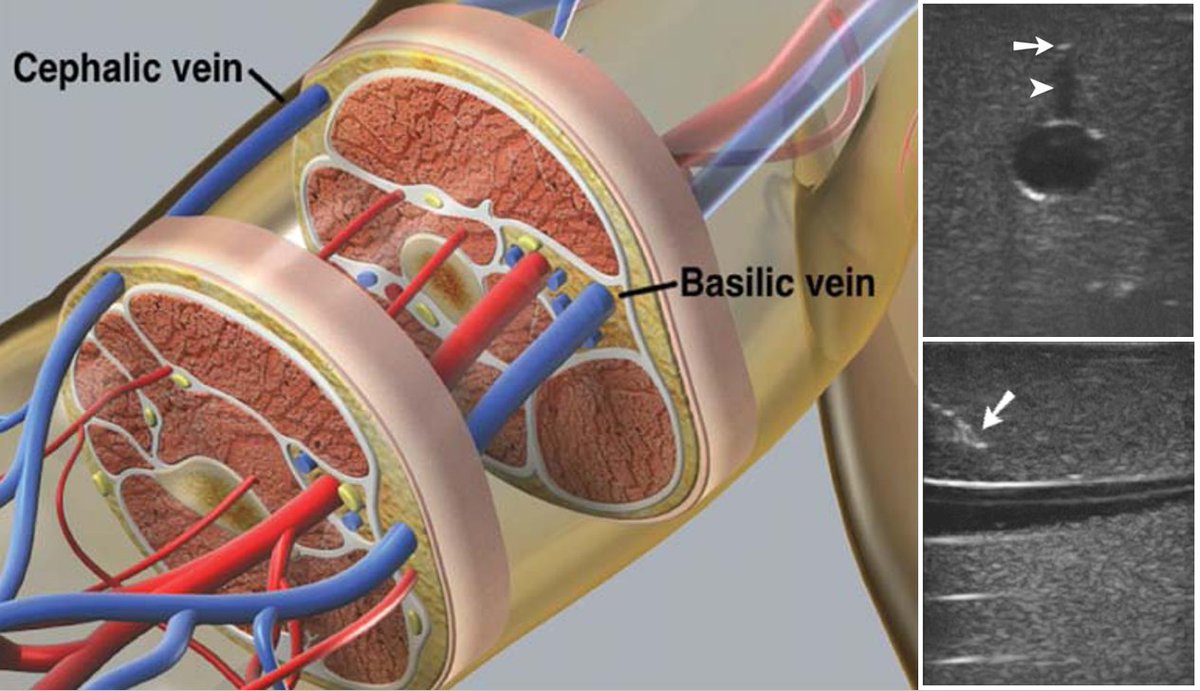 NephroPOCUS tweet media
