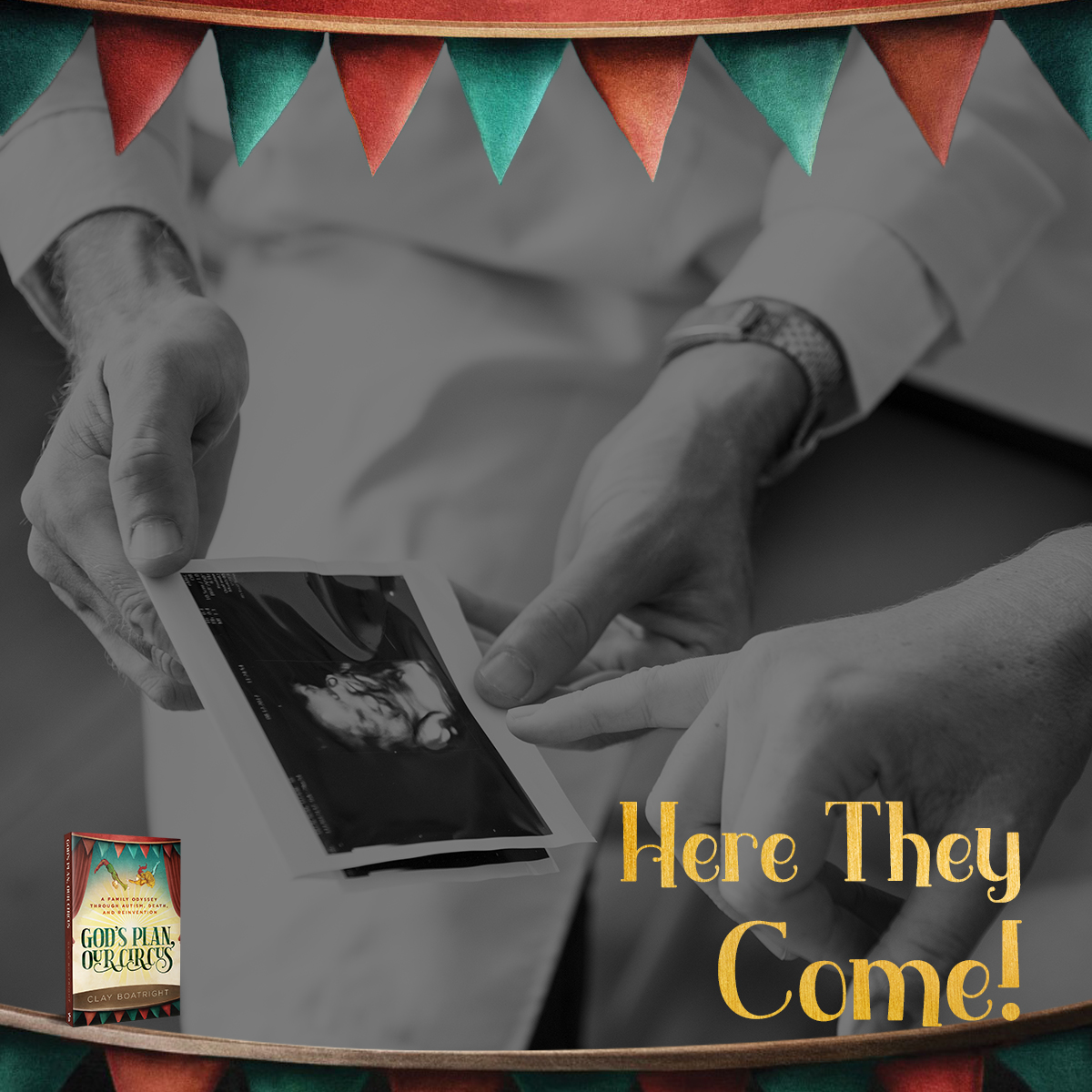 god_circus's tweet photo. The author Clay Boatright shares the day when he first saw the picture of the ultrasound.

Regardless of the shape, he was in love. 
His eyes started to sweat when Carole walked out and sat next to him.

Find out what Carole asked Clay.
https://t.co/5oRd31ttiL https://t.co/W9YS4DRc7c