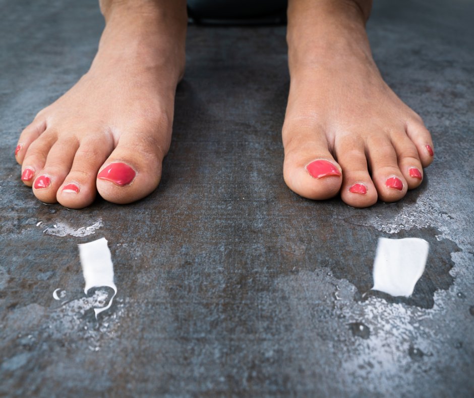 Gapodiatry's tweet photo. Are stinky, sweaty feet getting the best of you? It's time to take action. Learn how to combat sweaty feet in this week's blog. Do your feet sweat more than usual? Call our team at Georgia Podiatry for help! https://t.co/XFDAF6oH7E https://t.co/ZoyLysGxgb