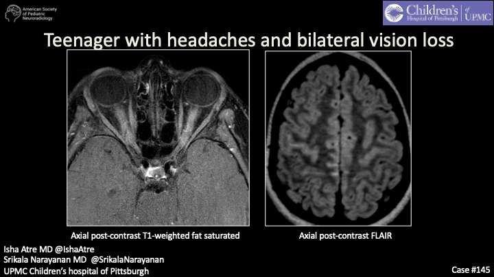 American Society of Pediatric Neuroradiology tweet media