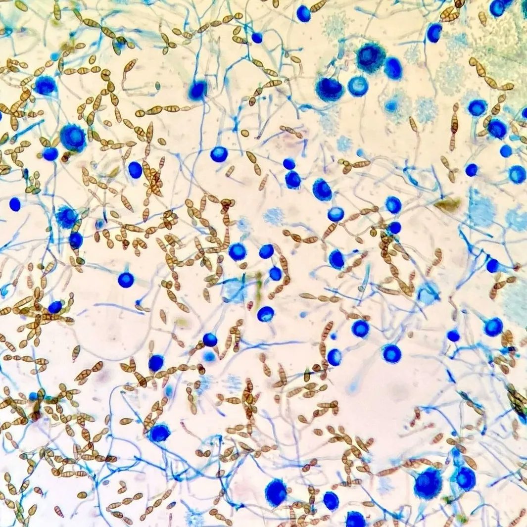 Alternaría &amp; Apergillus 💙 Tinción Azul de Lactofenol.

📷:Ig:  v.esc