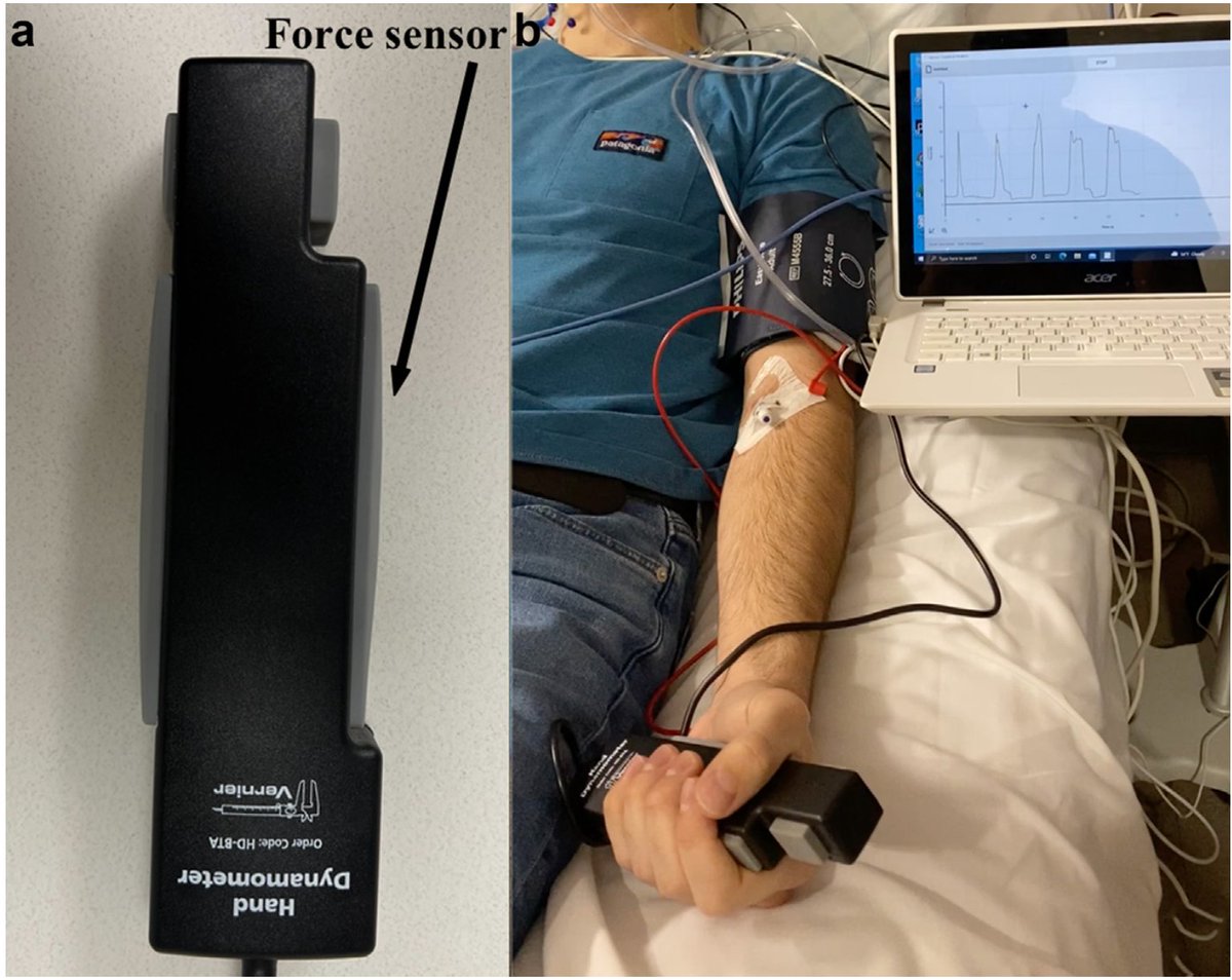 Christian S. Guay, MD (@christianguaymd) on Twitter photo How do you measure conscious state transitions without any external stimulation? Find out in our new paper just published in <a href="/BJAJournals/">British Journal of Anaesthesia</a>, freely available for the next 50 days: authors.elsevier.com/a/1goh11dCDq-Jk
<a href="/avidan_michael/">Michael Avidan</a> <a href="/BenPalanca/">Ben Palanca</a> @WUSTL_AnesRsrch <a href="/MGHanesthesia/">Mass General Anesthesia</a> <a href="/MIT_Picower/">MIT Picower Institute</a> How do you measure conscious state transitions without any external stimulation? Find out in our new paper just published in <a href="/BJAJournals/">British Journal of Anaesthesia</a>, freely available for the next 50 days: authors.elsevier.com/a/1goh11dCDq-Jk
<a href="/avidan_michael/">Michael Avidan</a> <a href="/BenPalanca/">Ben Palanca</a> @WUSTL_AnesRsrch <a href="/MGHanesthesia/">Mass General Anesthesia</a> <a href="/MIT_Picower/">MIT Picower Institute</a>