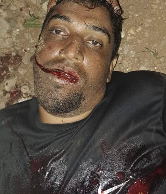 InforTvenezuela's tweet photo. Carlos Gómez alias "El Conejo" resulto abatido por la Policía Nacional (PNB) en Irapa,edo Sucre.
Una semana después de la detención de Pedro Hernández,alcalde de Las Tejerías,con quien tenía nexos. 
El cadáver fue enviado a la morgue de Bello Monte,Caracas
#GameOver #BugsBunny# https://t.co/ZeE29QwJgl