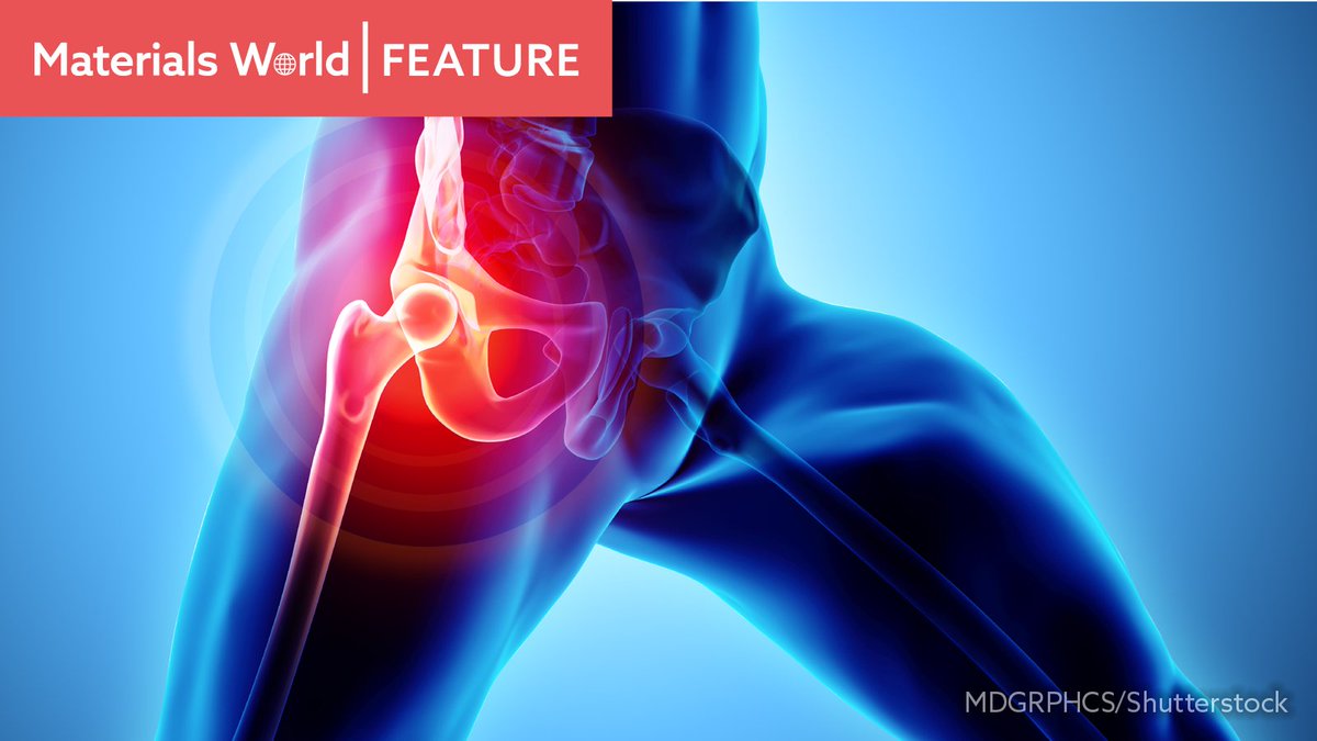 materialsworld's tweet image. An  overview of #hipreplacements, revisions and microfluidics is addressed in the discussion of anovel #smartsensor for #hipimplants by Professor Sohini Kar-Narayan FIMMM @Kar_Narayan_Lab and Dr Jehangir Cama @CamaJehangir of @ArtioSense Limited, UK, fit: bit.ly/3JxTVrF