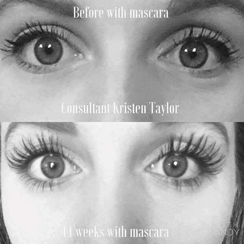 SusanHelmberge2's tweet image. #LASHBOOST
#RODANANDFIELDS