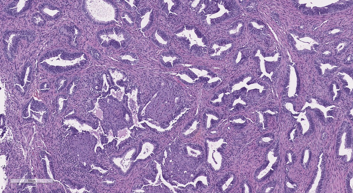 Elizabeth Kertowidjojo, MD, PhD, MPH tweet media