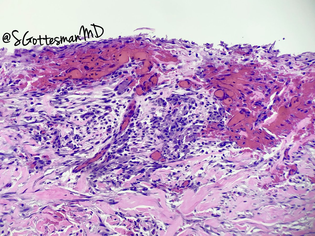 Silvija Gottesman MD tweet media