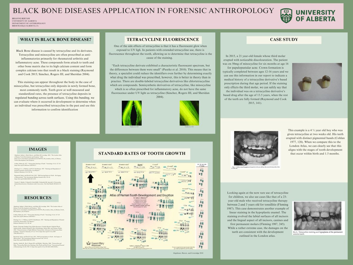Very thankful to have come runner up this year <a href="/frucht_agas/">Richard Frucht Memorial Lecture Series</a> ! For my poster proposing how we can use black bone disease for secondary identification
