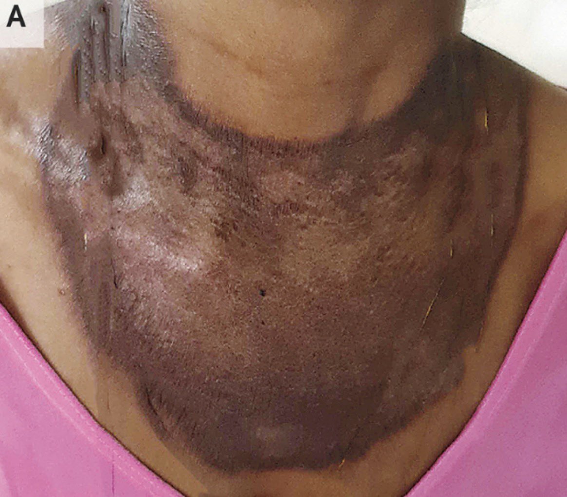 Keith Siau tweet media