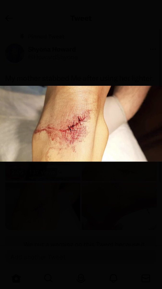 HowardShyona's tweet photo. Mother stabbed me and allowed my ex to rape me in the next room,I was getting raped and abused. She then stolen money after I became homeless. Becoming homeless I had been sexually assaulted but people I thought I could trust. ##gofundme #foryoupage Link: https://t.co/CMaUlaarea https://t.co/BdOmH9ldRa