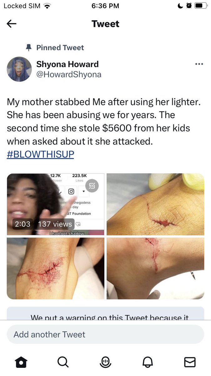 HowardShyona's tweet photo. Mother stabbed me and allowed my ex to rape me in the next room,I was getting raped and abused. She then stolen money after I became homeless. Becoming homeless I had been sexually assaulted but people I thought I could trust. ##gofundme #foryoupage Link: https://t.co/CMaUlaarea https://t.co/BdOmH9ldRa