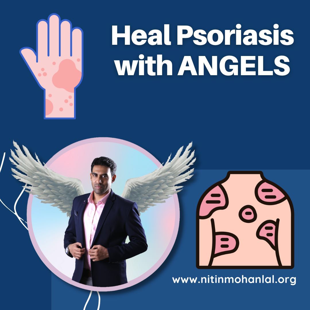 nitinmlall's tweet photo. Dear Earth Angels

Heal Psoriasis with ANGELS

You..For more info visit...https://t.co/n3oKaXXvgU https://t.co/bOjzKOrqcV