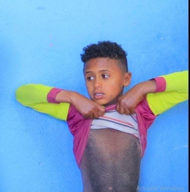 HagosSuzan's tweet photo. The use of weaponized rape, killing , burning against children in Tigray is a heinous violation of human rights that cannot be ignored. The international community must prioritize the protection and justice for the #ChildrenOfTigray. #Justice4Tigray @UNGeneva @UNHumanRights
😭😭 https://t.co/Wgczxs2D0z