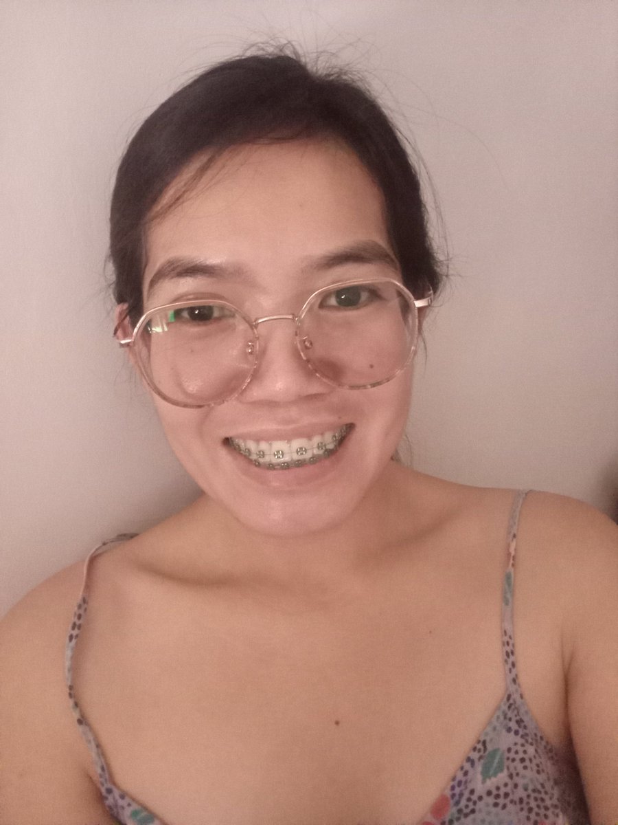 Rolieme22's tweet image. 100th day of braces 😁

#overbite