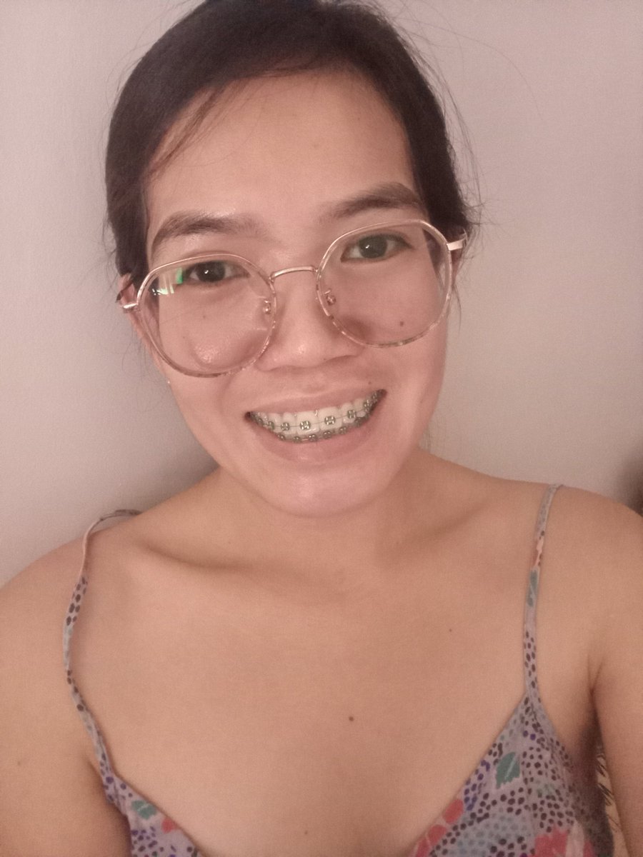 Rolieme22's tweet image. 100th day of braces 😁

#overbite