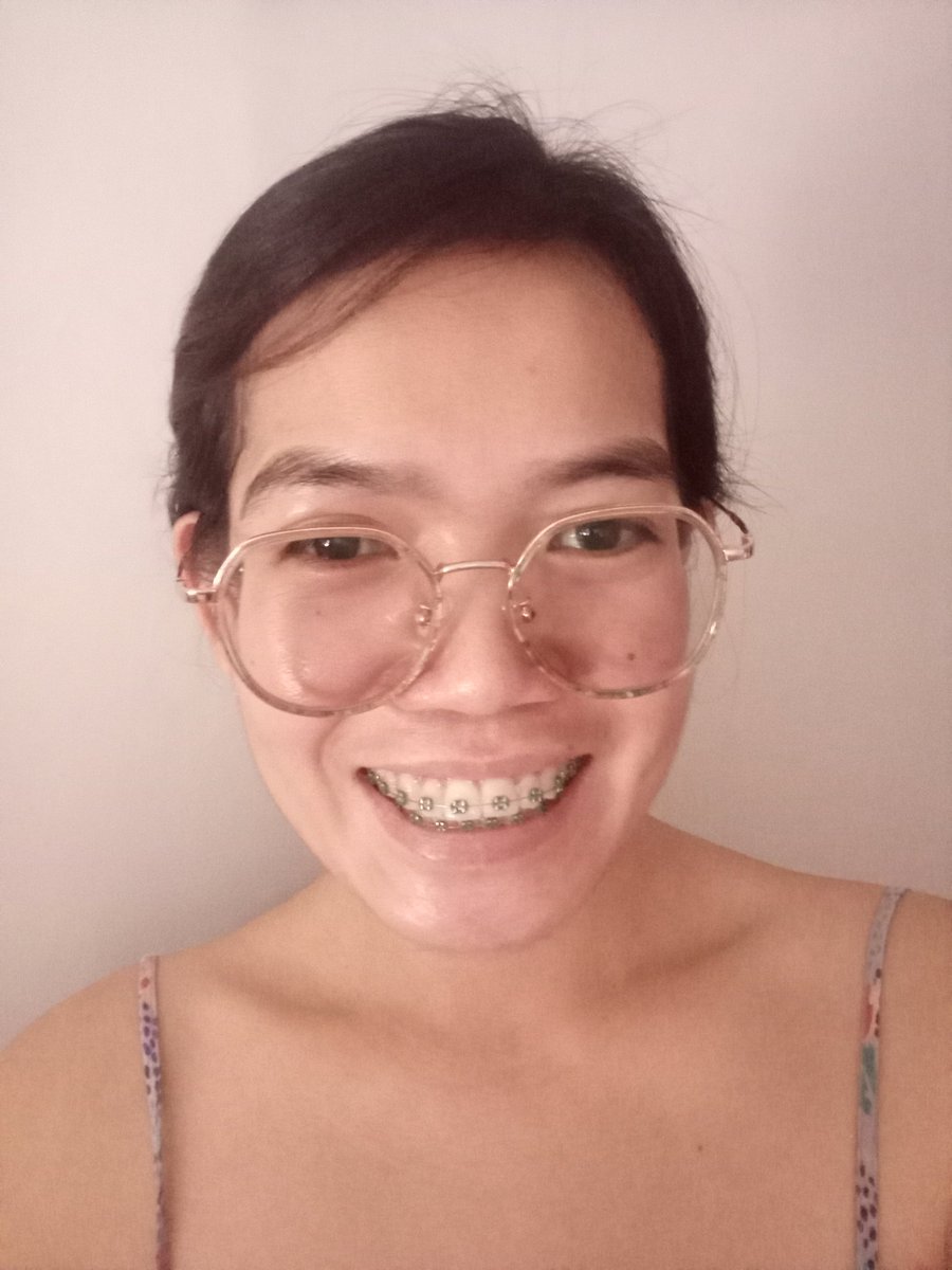 Rolieme22's tweet image. 100th day of braces 😁

#overbite