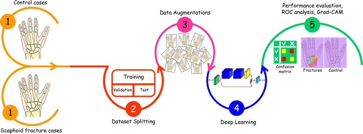 Alimedphysics's tweet photo. Our proposed #AI model detected #ScaphoidFractures with 90% accuracy! It can be a beneficial alternative to MRI for early fracture detection (especially occult) on radiographs. See more on Engineering Applications of Artificial Intelligence: https://t.co/H2ItIwElDb.
@comp_science https://t.co/MtgculIz4H