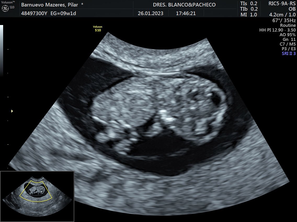 Salvador Garcia-Ayllon tweet media